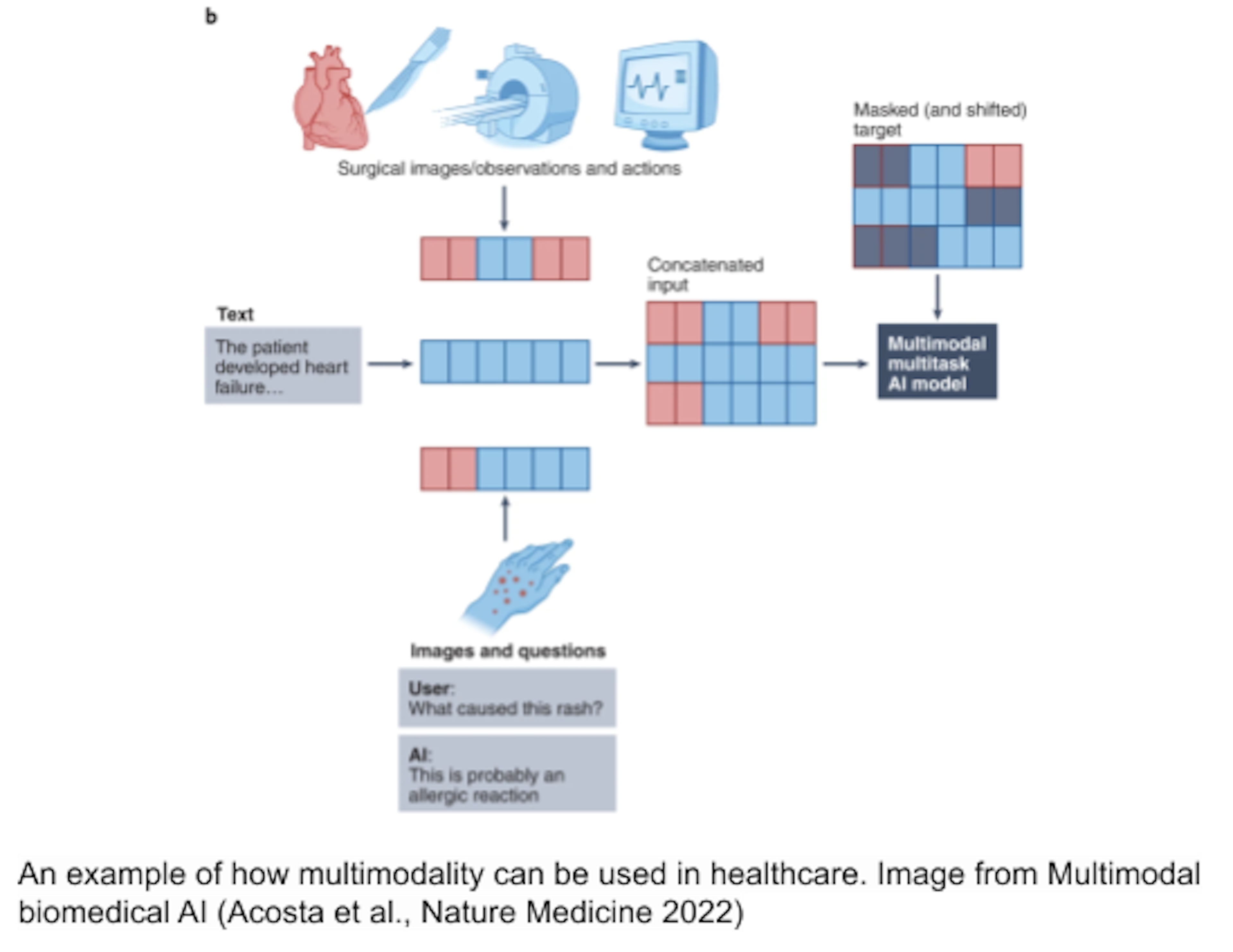 An example of how multimodality can be used in healthcare. Image from Multimodal biomedical AI (Acosta et al., Nature Medicine 2022)